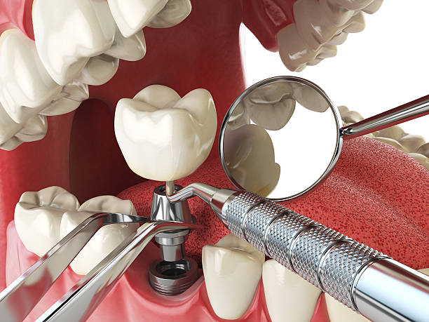 Best Emergency Broken Tooth Repair in Country Knolls, NY